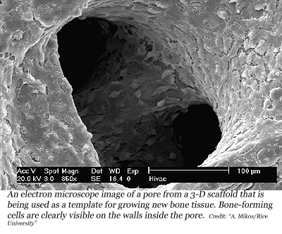 electron microscope image of a pore from a 3-D scaffold that is being used as a template for growing new bone tissue. Bone-forming cells are clearly visible on the walls inside the pores