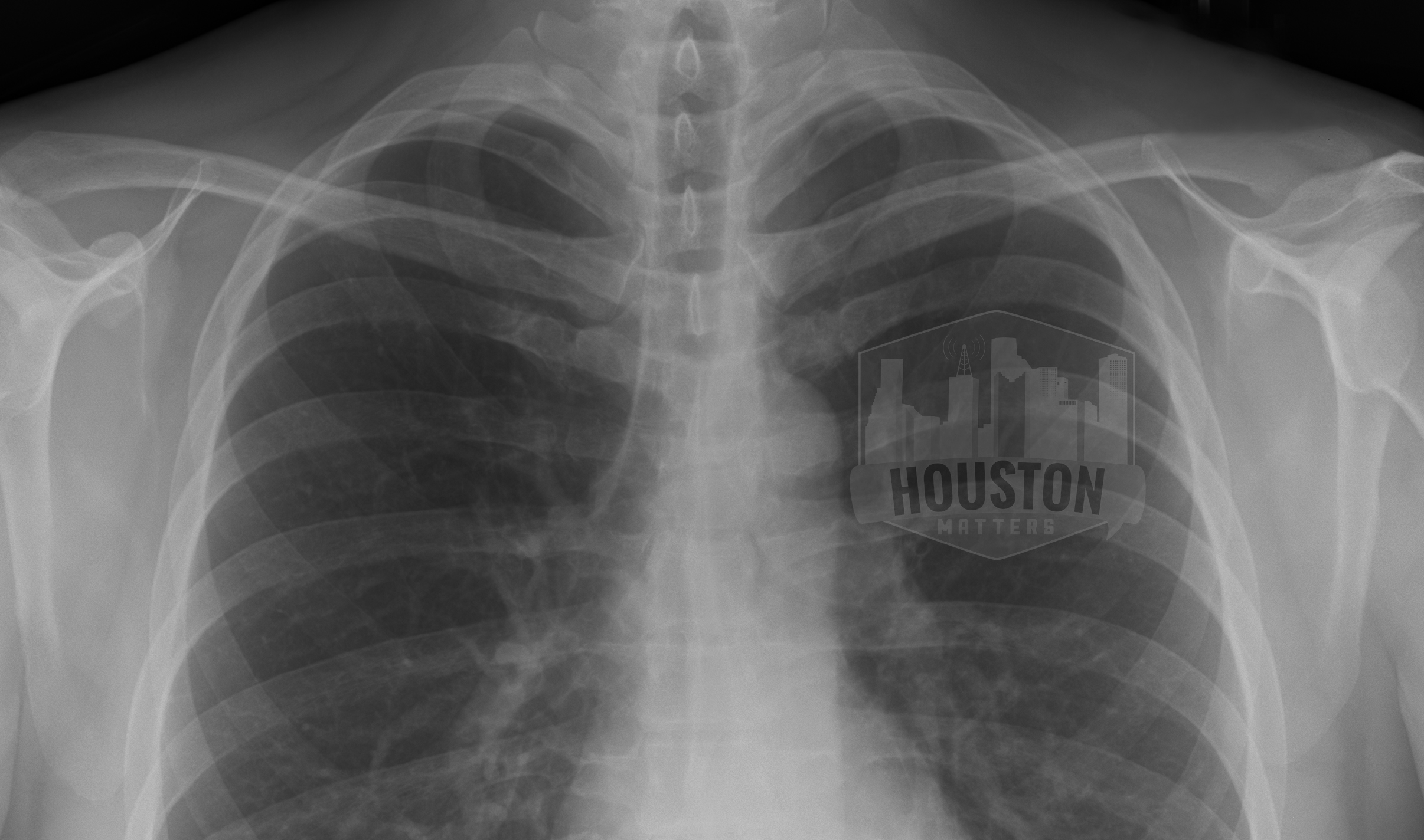 Houston Matters X-Ray