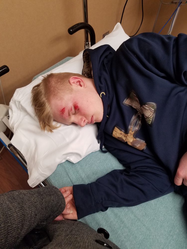 This photo shows bruises Trysten Pearson, 16, sustained on his forehead and left eye because of a recent seizure.
