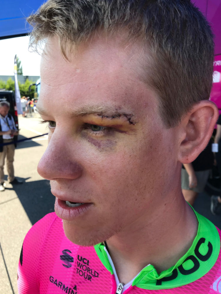 In this July 10, 2018 image, Lawson Craddock of the U.S. talks to reporters in La Baule, France, prior to the start of the fourth stage of the Tour de France cycling race. After breaking his shoulder and bloodying his face in an unfortunate crash during the first stage of the Tour de France, American rider Lawson Craddock has soldiered through six more grueling days of the world's biggest bike race.