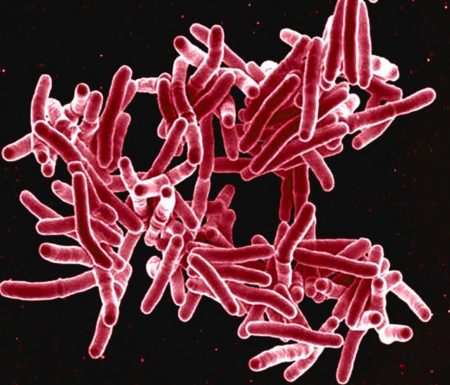 Produced by the National Institute of Allergy and Infectious Diseases (NIAID), this digitally colorized scanning electron microscopic (SEM) image depicts a grouping of red colored, rod shaped, Mycobacterium tuberculosis bacteria, which cause tuberculosis (TB) in human beings.