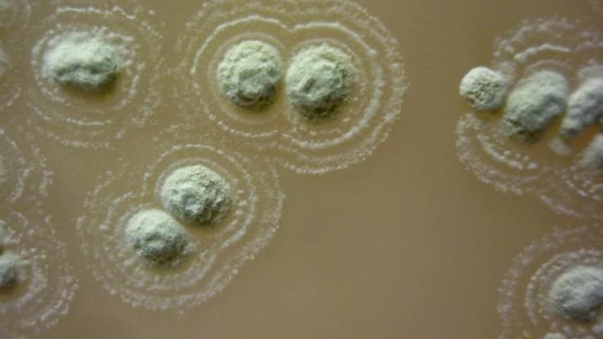 Bacteria-Discovered-in-Irish-Dirt