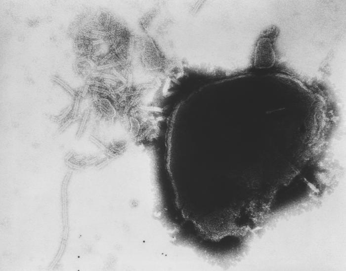 This transmission electron micrograph (TEM) shows the presence of numerous paramyxovirus virions, which in this instance, were responsible for a case of the mumps. 