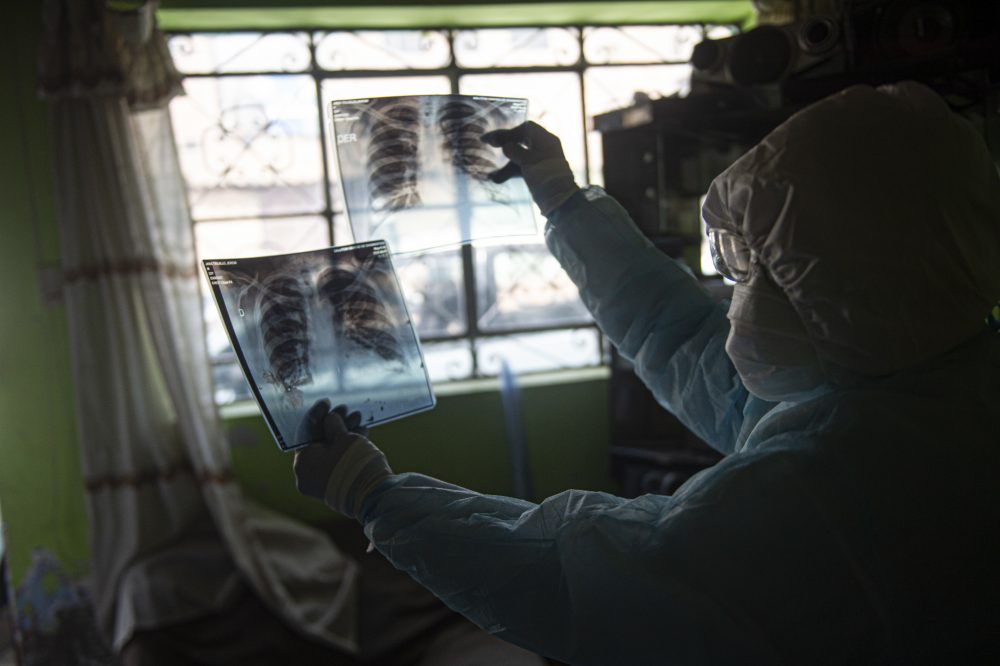 A doctor checks a lung X-ray while visiting a patient with COVID-19 in Comas, in the northern outskirts of Lima, Peru.