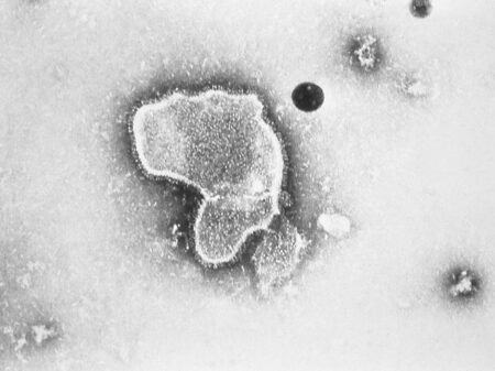This 1981 photo provided by the Centers for Disease Control and Prevention (CDC) shows an electron micrograph of Respiratory Syncytial Virus, also known as RSV. Children's hospitals in parts of the country are seeing a distressing surge in RSV, a common respiratory illness that can cause severe breathing problems for babies. Cases fell dramatically two years ago as the pandemic shut down schools, day cares and businesses. Then, with restrictions easing, the summer of 2021 brought an alarming increase in what is normally a fall and winter virus. (CDC via AP)